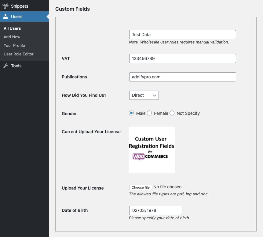 Custom User Registration Fields - WooCommerce